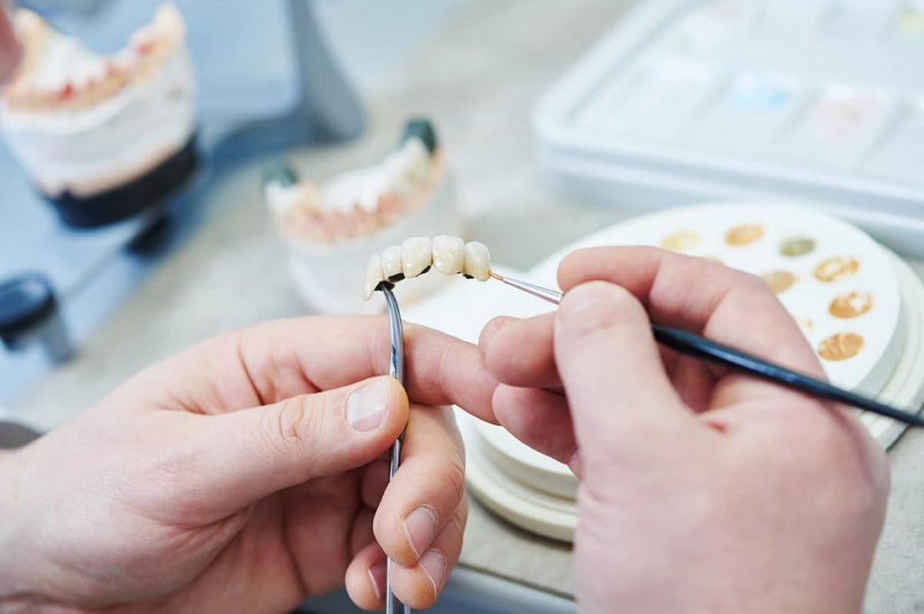 Протезирование зубов и его особенности