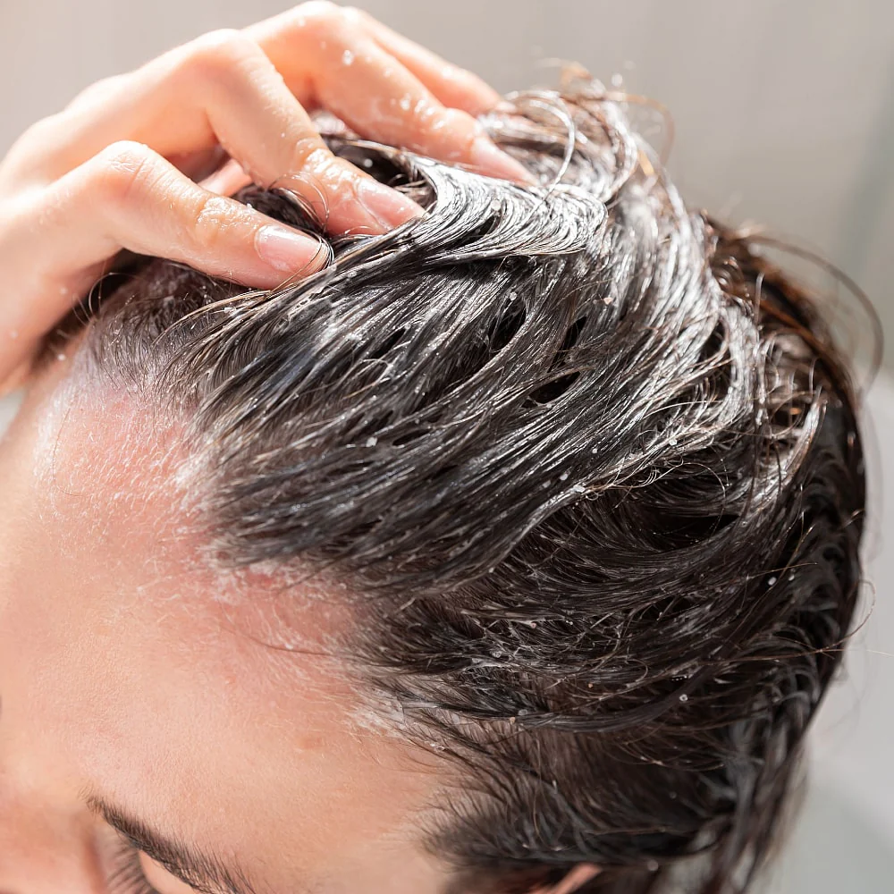 Чому скраб для шкіри голови важливий для здоров'я вашого волосся?